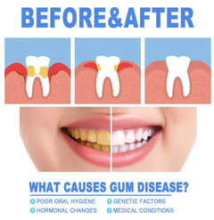 Teeth Repair Gel
